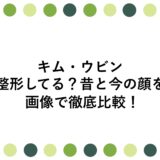 キム・ウビンは整形してる？昔と今の顔を画像で徹底比較！