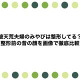 破天荒夫婦のみやびは整形してる？整形前の昔の顔を画像で徹底比較