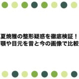 夏焼雅の整形疑惑を徹底検証！顎や目元を昔と今の画像で比較